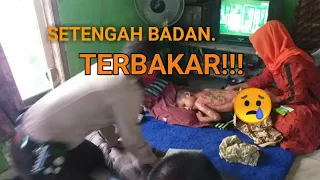 MEMBAWA ANAK KORBAN LUKA BAKAR KE RUMAH SAKIT!!! MOHON DOANYA AGAR CEPAT SEMBUH AMIN🙏