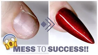 HOW TO FIX A SHORT BROKEN DAMAGED NAIL | GEL AND SILK
