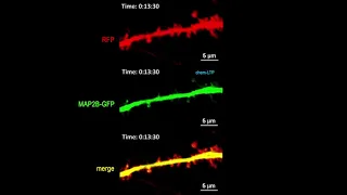 LTP-induced translocation of MAP2 to dendritic spines