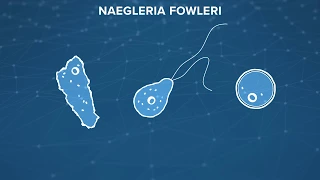Naegleria Fowleri (the brain-eating amoeba): What is it? How do you prevent it?