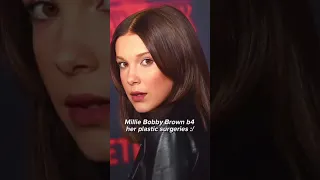 Millie Bobby Brown  before her plastic surgeries #shorts #celebrity