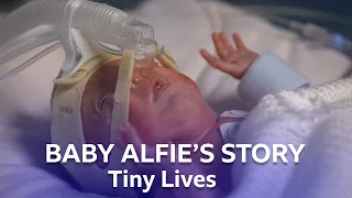 Premature Baby Alfie Arrives Three Months Early  | Tiny Lives Series 2 | BBC Scotland