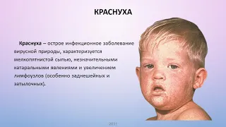 Инфекционные Экзантемы у детей