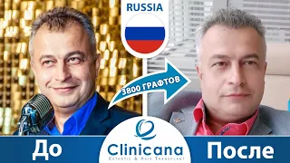 Видео отзыв Борис о клинике Clinicana, пересадка волос в Турции, лечение облысения, 3800 графтов