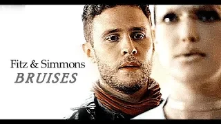 Fitz & Simmons | Bruises •°