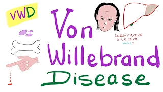 Von Willebrand Disease (VWD) | The Most COMPREHENSIVE Explanation!