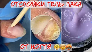 Жуткие отслойки на ногтях 😱 Маникюр на короткие ногти 💗