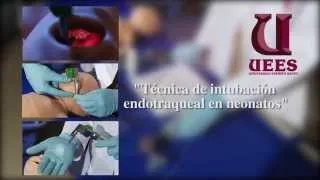 Simulación Médica #1 "Técnica de intubación endotraqueal en neonatos"