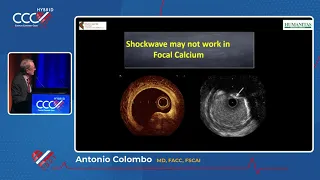 What is New in Interventional Cardiology 2021 - Antonio Colombo, MD, FACC, MSCAI