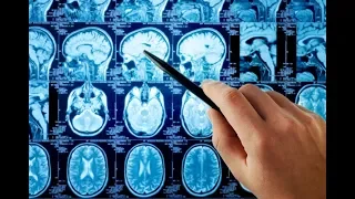 Как размер мозга влияет на интеллект? #DARWINews 7.2.2