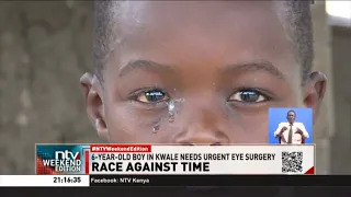 6-year-old in Kwale needs urgent surgery after electrical equipment accident