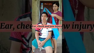 EAR, JAW, CHEEK INJURY BANDAGING