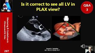 Q&A 3: Is it correct to see all LV in PLAX view?