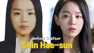 Shin Hae-sun before and after
