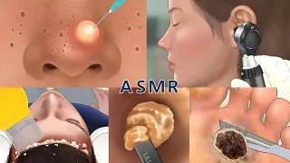 Care Animation Collection 4 (no music) | nose, foot, hair, ear care | 코피지, 발사마귀,귀청소, 머릿니