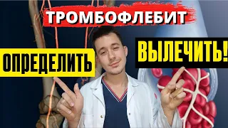 Тромбофлебит глубоких и поверхностных вен | Симптомы Лечение