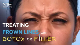 What's Best, BOTOX® or Fillers For Frown Lines? | Mabrie Facial Institute in San Francisco, CA