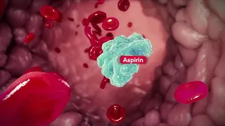 ASPIRIN