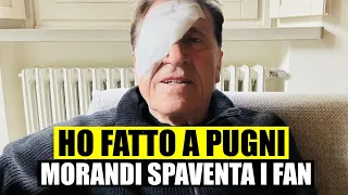 GIANNI MORANDI HA FATTO A PUGNI: SUI SOCIAL CON UNA GRANDE BENDA SULL'OCCHIO. I FAN PREOCCUAPTI