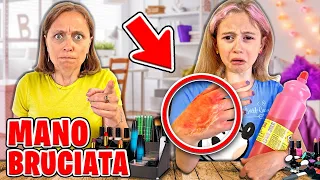 GIORGIA SI BRUCIA E SI FA MALE ALLA MANO CON L'ACETONE MENTRE USA I TRUCCHI DI MAMMA CINZIA *Piange*