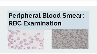 Peripheral Blood Smear: Examination of RBC