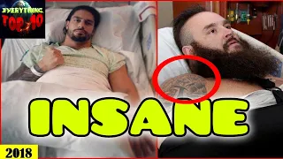 TOP 15 - Shocking WWE Superstars Surgery Photos You Must See *Roman Reigns, Braun Strowman & MORE*