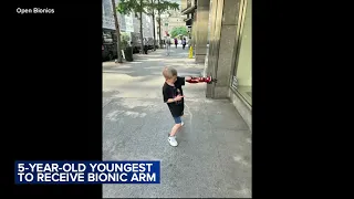 5-year-old boy from New York believed to be youngest person to receive bionic arm