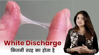 सफ़ेद पानी के कारण, इलाज और बचाव || White Discharge in Women Causes Symptoms and Prevention |