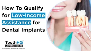 How To Qualify for Low Income Assistance for Dental Implants  ToothHQ Dental Implant Special
