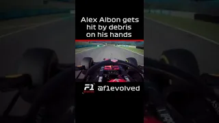 Alex Albon Gets Hit By debris on His Hand #Shorts