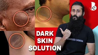 Dark Skin On Neck & Armpits - Reason & Solution | Bearded Chokra