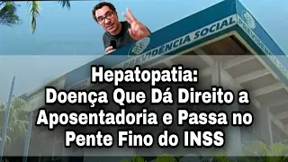 Hepatopatia: Doença Que Dá Direito a Aposentadoria e Passa no Pente Fino do INSS