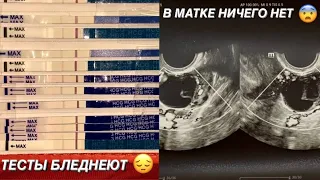 ПОШЛА КРОВЬ НА 6 НЕДЕЛЕ БЕРЕМЕННОСТИ 😰 ч.4