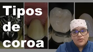 Tipos de coroa dentária | Dra Bianca Rosa