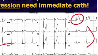 EM Cardiology Course with Dr. Amal Mattu - On-line/real-time - Nov 10-11, 2020