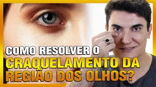 Como resolver o Craquelamento da Região dos Olhos?