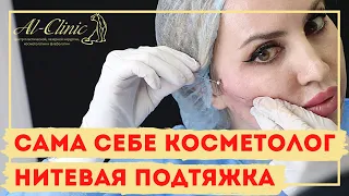 😱 САМА СЕБЕ КОСМЕТОЛОГ | Нитевая подтяжка лица | Нитевой лифтинг - как проходит процедура?