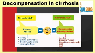 Cirrhosis stages - decompensated cirrhosis - cirrhosis of liver - small talk series