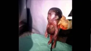 Woman Gives Birth to Goat looking Baby with No NeckPHOTO