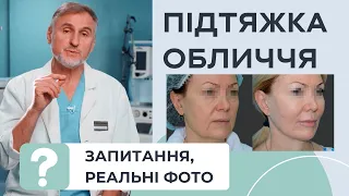 ПІДТЯЖКА ОБЛИЧЧЯ — ВІДПОВІДІ НА ЧАСТІ ПИТАННЯ