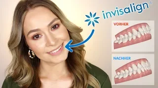 Unsichtbare Zahnspange ? 😬  INVISALIGN Kosten | Erfahrung | Schmerzen