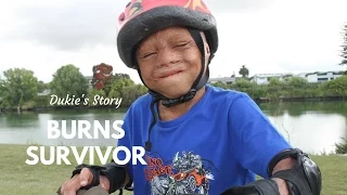 Burns Survivor: Dukie's Story