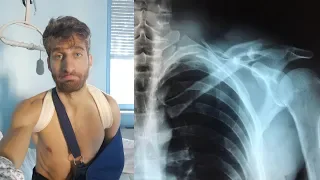 HOW DID I BREAK 6 BONES ON THE PITBIKE? - I ANALYZE THE ACCIDENT [English Subtitles]