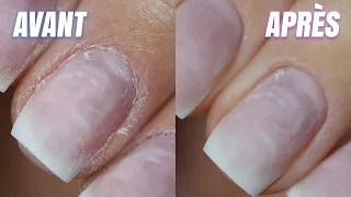 How to have perfect cuticles?