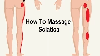 How To Reduce Sciatica Pain with Massage (Trigger Point)