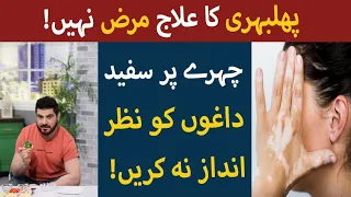 Phulbehri Ka Ilaj In Urdu - Vitiligo Treatment -  Khurram Mushir - Morning Star