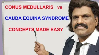 CONUS MEDULLARIS  vs CAUDA EQUINA SYNDROME CONCEPTS MADE EASY