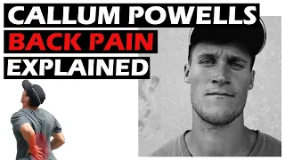 Callum Powell's back pain explained [Storror athlete analysis 4]