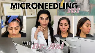 Microneedling: What you need to know! | Dr. Azi