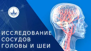 🔬 Показания для исследования сосудов головы и шеи. Исследование сосудов головы и шеи. МНОЦ МГУ. 18+